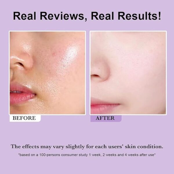 AHA/BHA Clarifying Treatment Toner(150ML) - Image 4