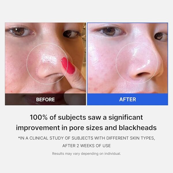 Zero Pore Pads 2.0 155G - Image 4